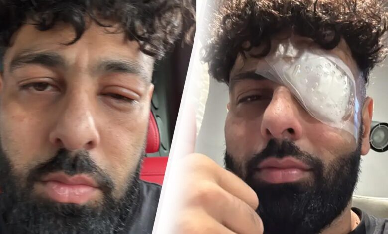 Badshah : સોશિયલ મીડિયા પર ફોટો વાયરલ, ચાહકો ચિંતામાં પણ વાસ્તવિકતા કંઈક અલગ 1 thenewsdk.in