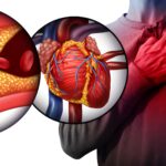 Heart Blockage : ચાલતાં જ ફૂલવા લાગે છે શ્વાસ તો સાવધાન! હૃદયની બીમારીનું હોઈ શકે ચેતવણીરૂપ લક્ષણ